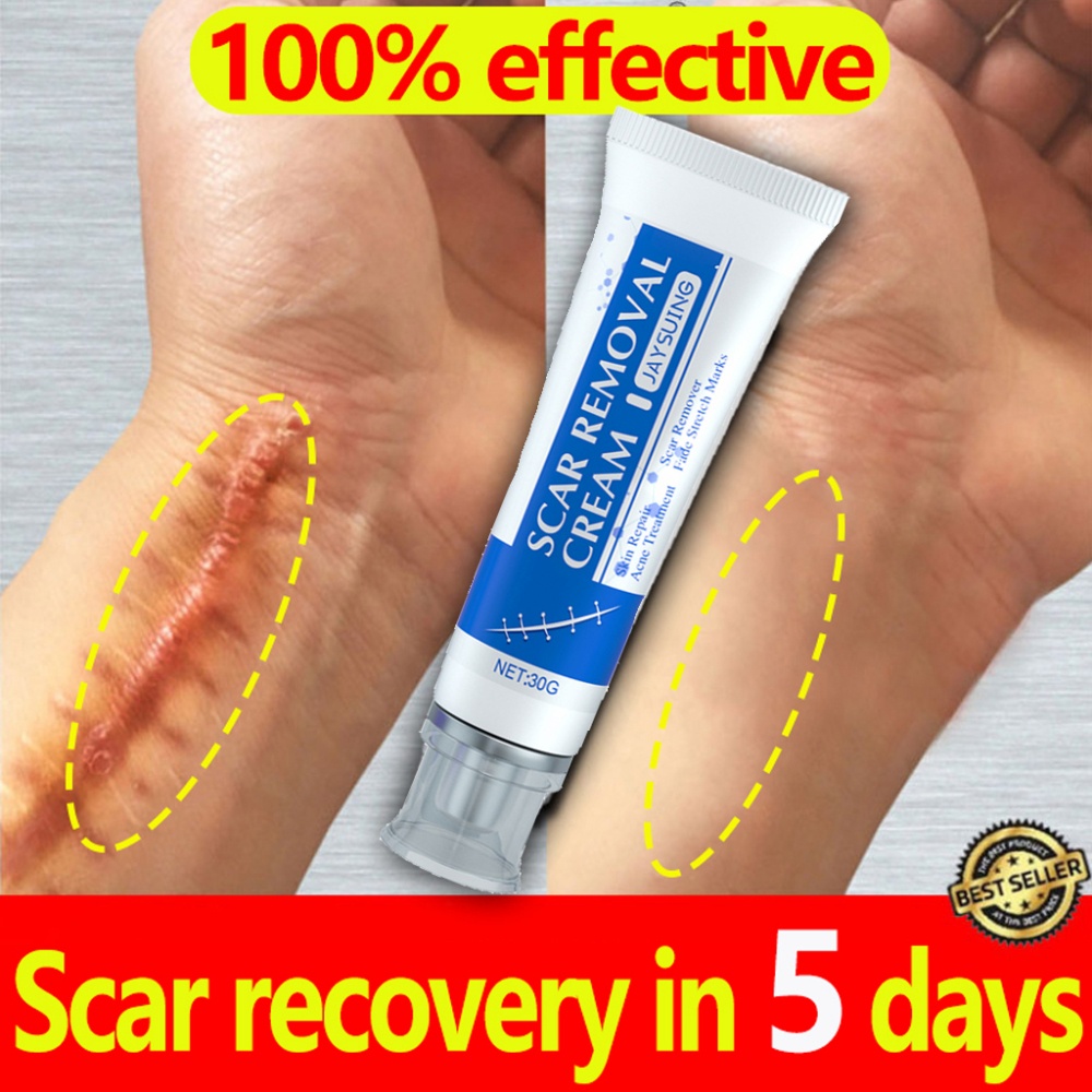 Scar Remover for Old Scar on Leg Scar Gel Original Stretch Mark Remover