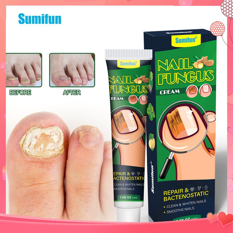 sumifun-nail-fungus-cream-repair-onychomycosis-reduce-nail-fungal