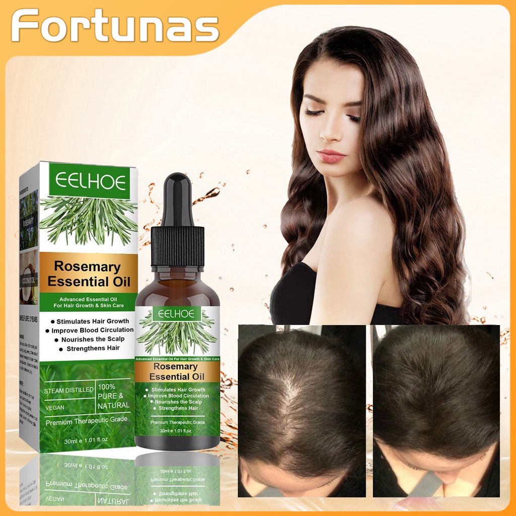 Eelhoe Rosemary Hair Essential Oil Rosemary Growth Nourishing Scalp ...