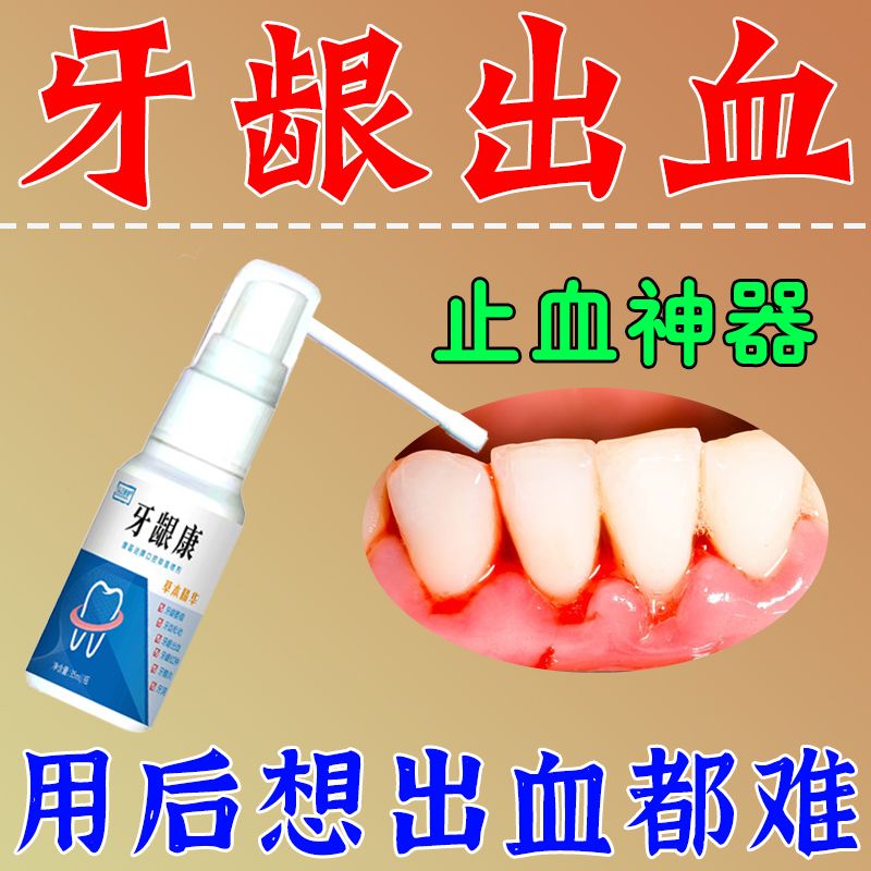 Repeated gum bleeding, gum swelling and pain, gingivitis, brushi ...