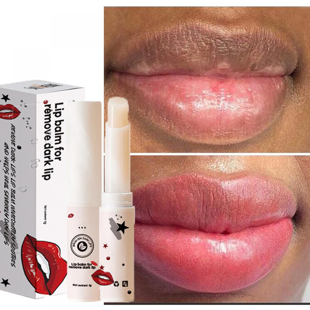 Lip Lightening Lip Balm Removal Black Lip Natural Lip Whitening ...