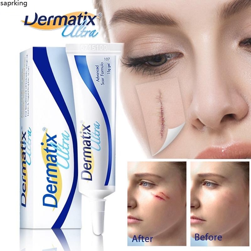 Dermatix Scar Silicone Gel Ointment Scars Caesarean Section Pimple Bump