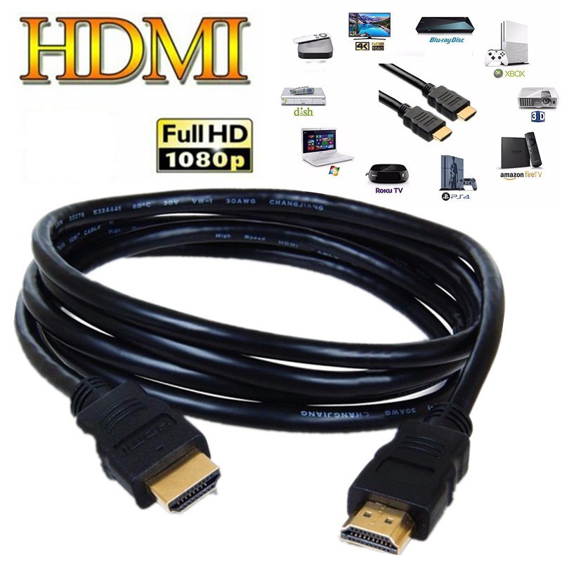 Buy hdmi Products At Sale Prices Online - August 2026 | Shopee Singapore