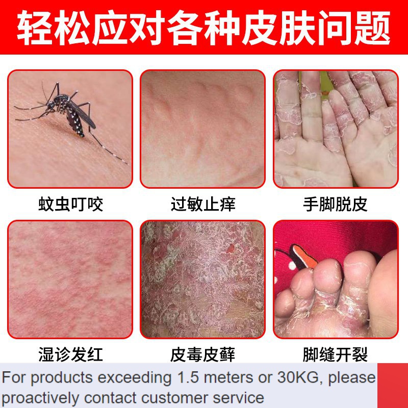 LP-8 On sale🔥General Pi Ointment Treatment of Psoriasis Eczema ...