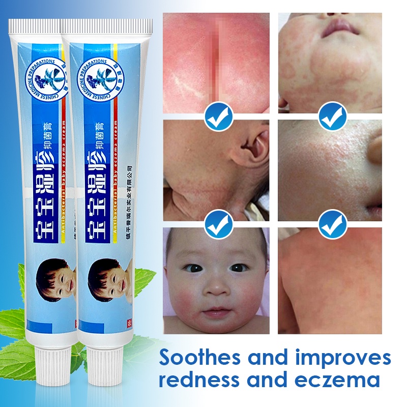 Baby Skin Repair Cream Treatment Kids Diaper Rash Psoriasis Dermatitis