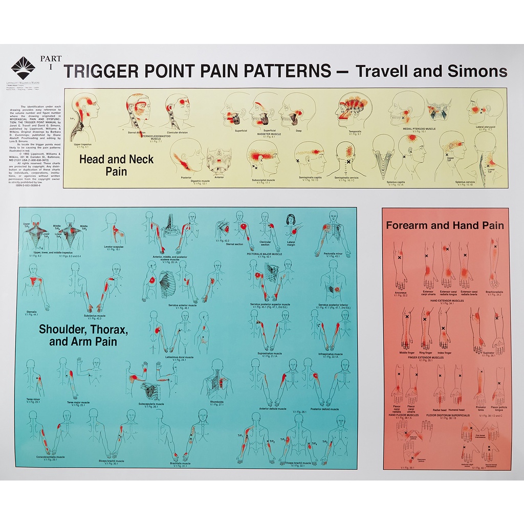 [sgstock] Travell and Simons' Trigger Point Pain Patterns Wall Charts ...