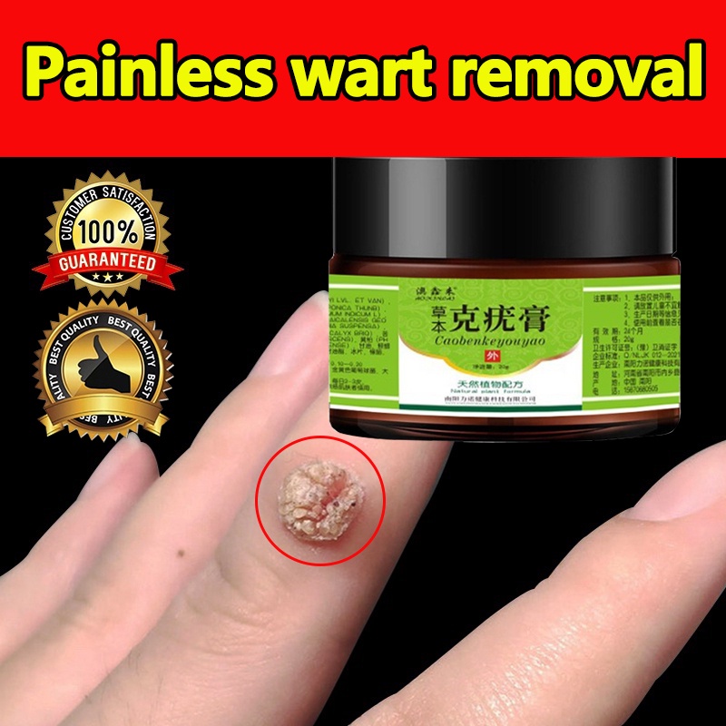 Wart Removal Cream Skin Tag Remover 20/50g Genital Wart Fast Anti Foot