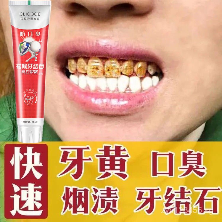 [New Store promotion] [dental calculus removal artifact] removing