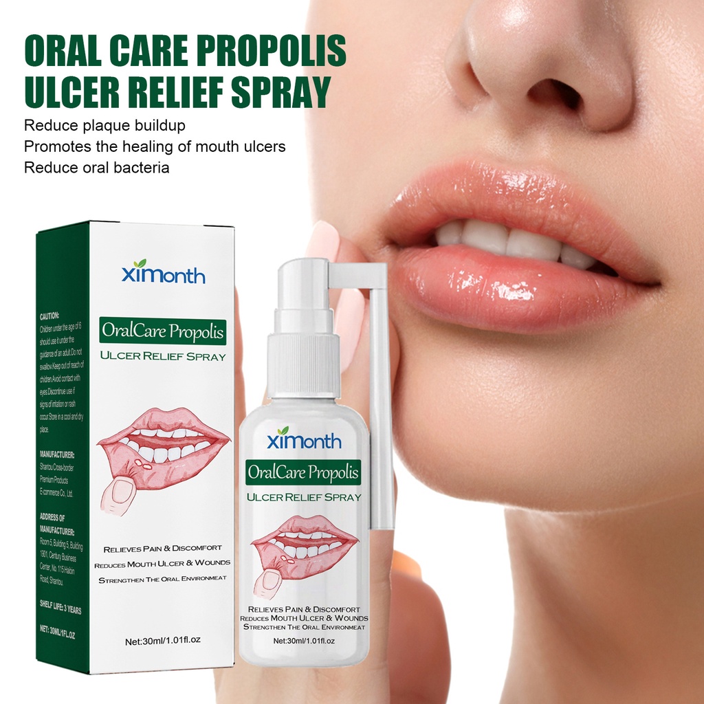 Oral Ulcer Spray Treatment Pharyngitis Halitosis Sore Antibac Mouth