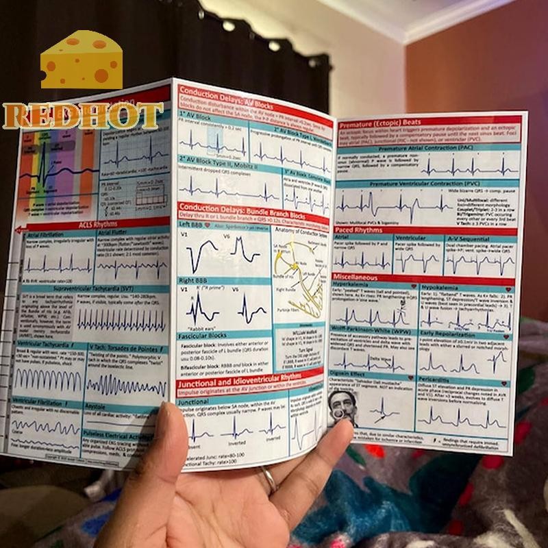 EKG Pocket Guide, EKG Rhythm Interpretation, Double Sided Compact ...