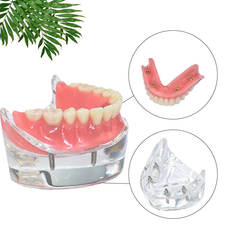 Dental Surgical tooth removable model Interior mandibular lower for ...
