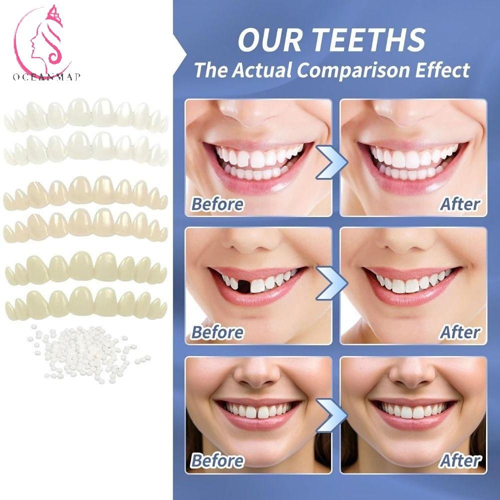 OCEANMAP 6Pcs DIY Tooth Repair Kit, with Moldable Thermal Beads 3 ...