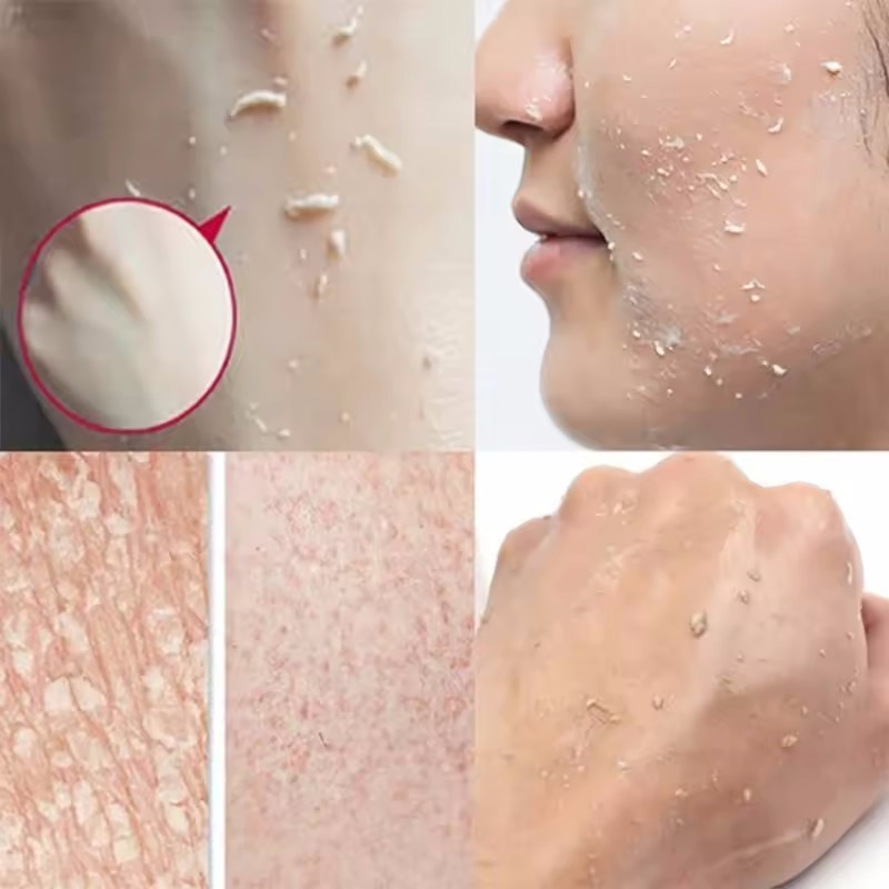 Product image Orange Whitening Exfoliating Gel Brightening Whitening Gentle Exfoliating Remove Chicken Skin Acne Moisturizing Body Care 7
