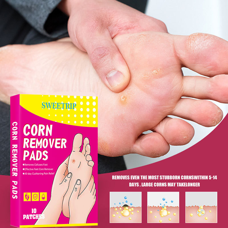 Ke Wart Stickers Painless Remove Tuo Calluses You Yanzi Hand Foot Corn ...