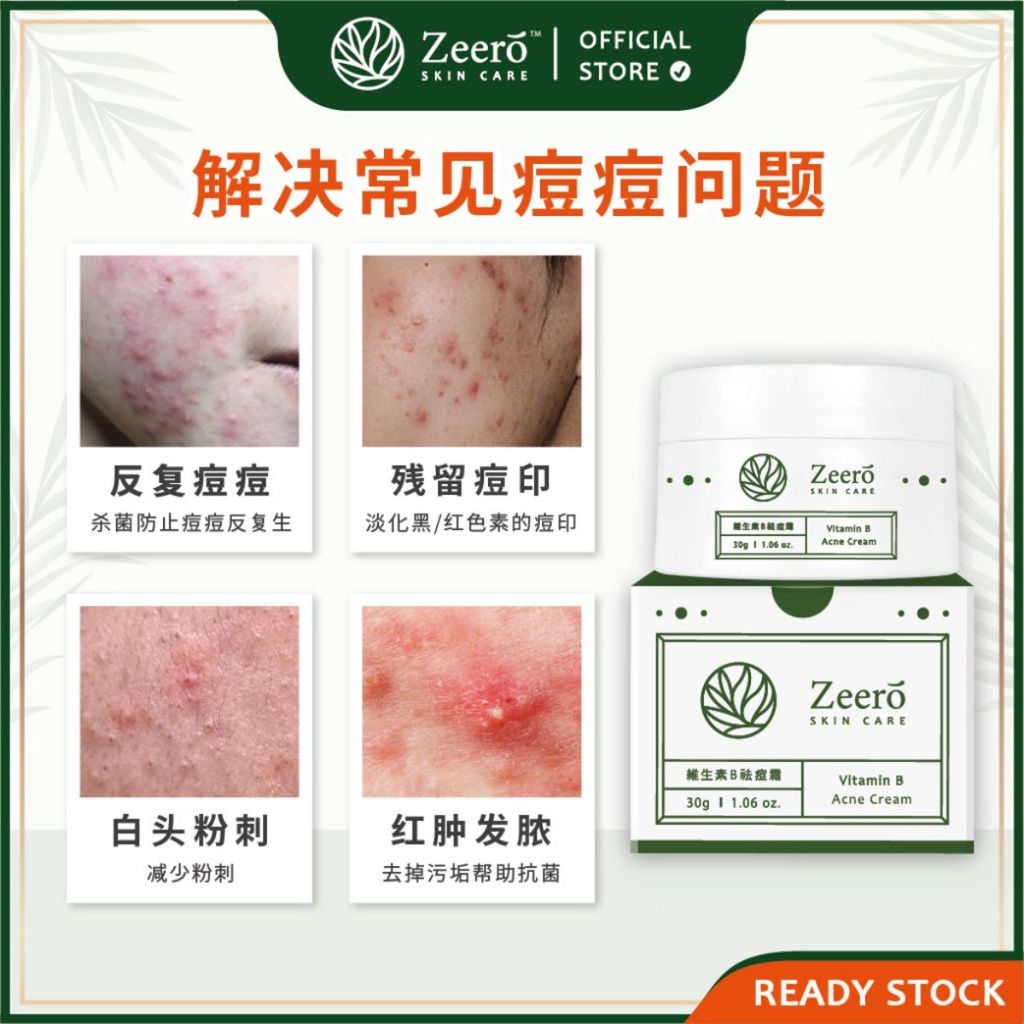 Zeero Tea Tree Oil Acne Cream Anti Acne With Vitamin B ( Zeero Vitamin