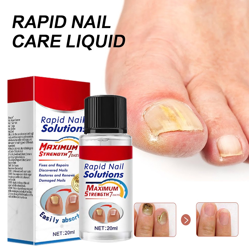 Nail Oil Treatment Essence Oil AntiFungal Nail Repair Serum Toenail