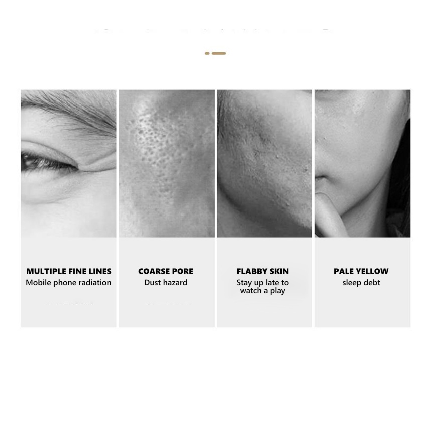 Face Filler Absorbable Collagen Protein Thread Face Lift Plump Silk