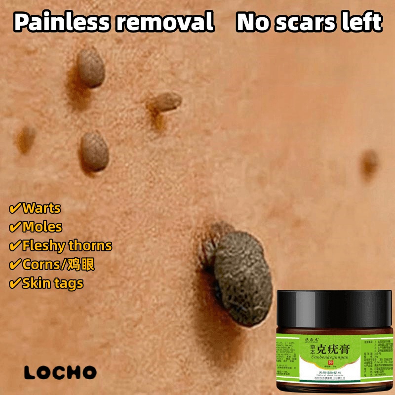 Warts removal cream Mole remover Skin tag removal 20g Safe and Painless