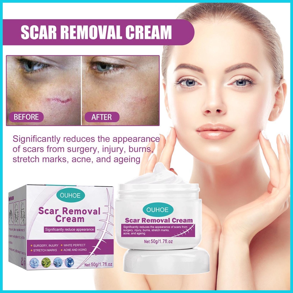 Burn Scar Cream Scar Balm for Stretch Mark Removal Scar Care Treat for ...