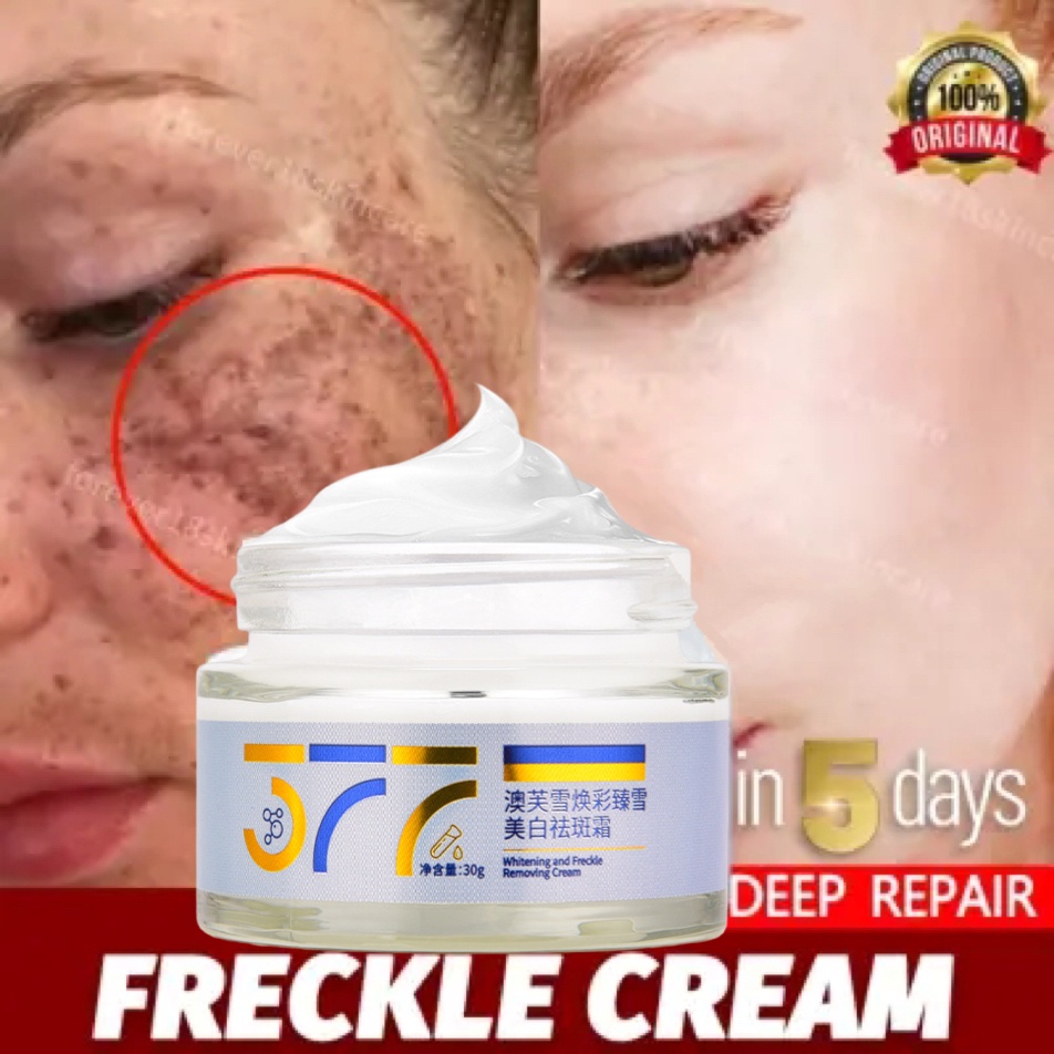 HITAM Whitening Freckle Cream 377 Cream Whitening Cream For Removing ...