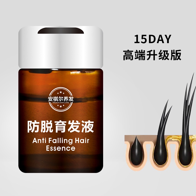 Antihair Loss Hair Lotion Shouwu Increase Hair Density Strengthen Hair