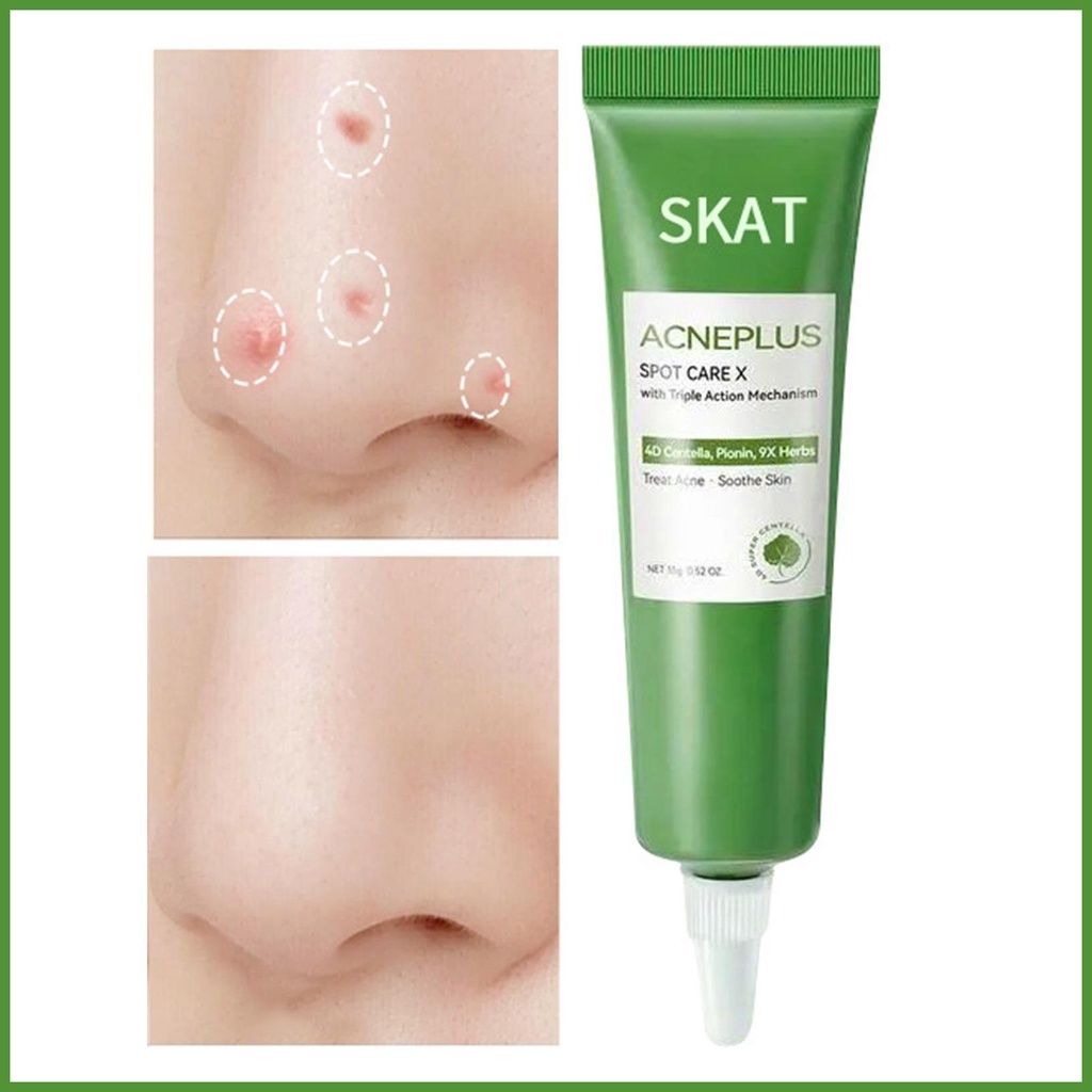 Pimple Cream Moisturizing Skin Repair Cream Herbal Pimple Removal Cream