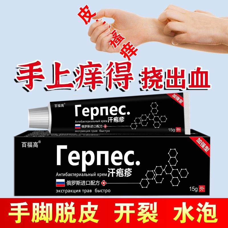 Oriental Premium# Sweat Herpes Goose Palm Chapped Hands And Feet Long 