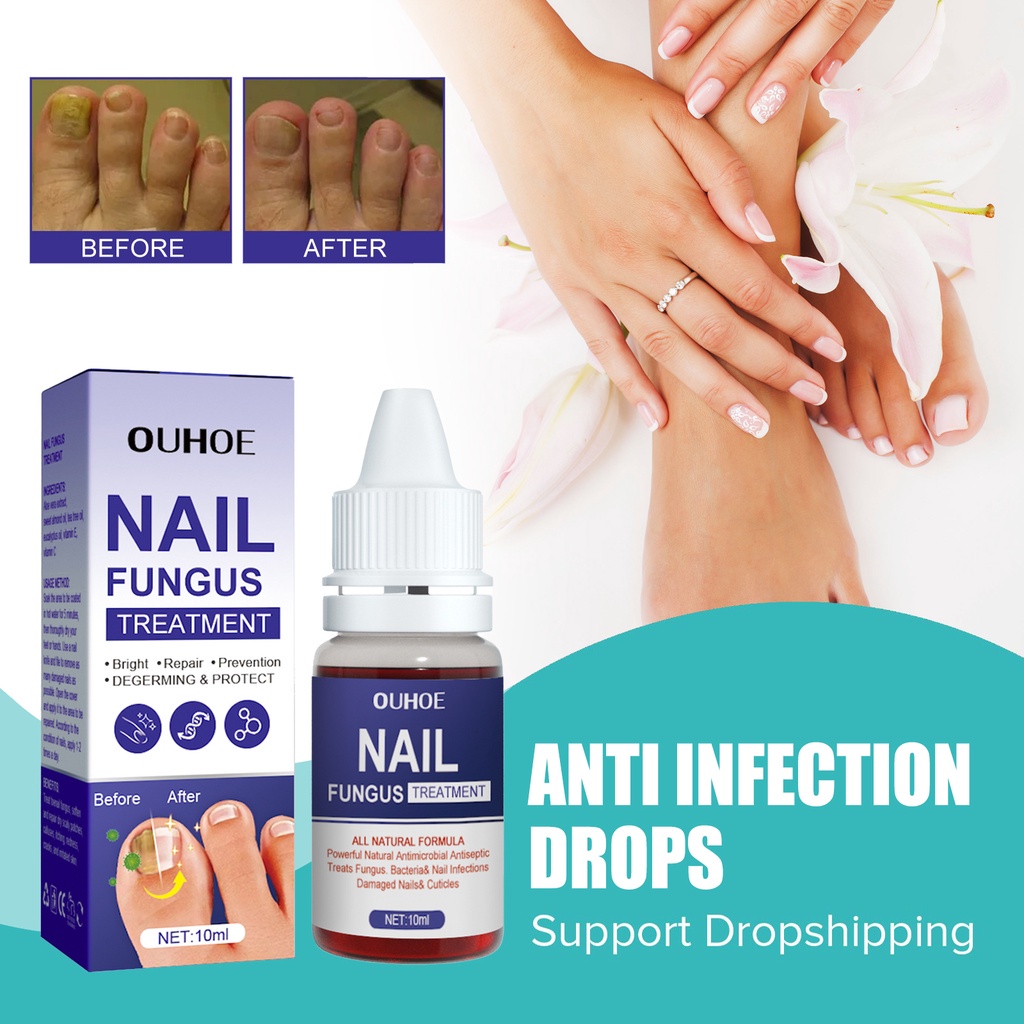 OUHOE Nail Fungus Treatment Nail Anti-infection Drops Repair Cracking ...