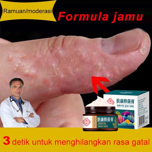 [100% Original] The Most Powerful Itching Salep Medicine For Skin ...