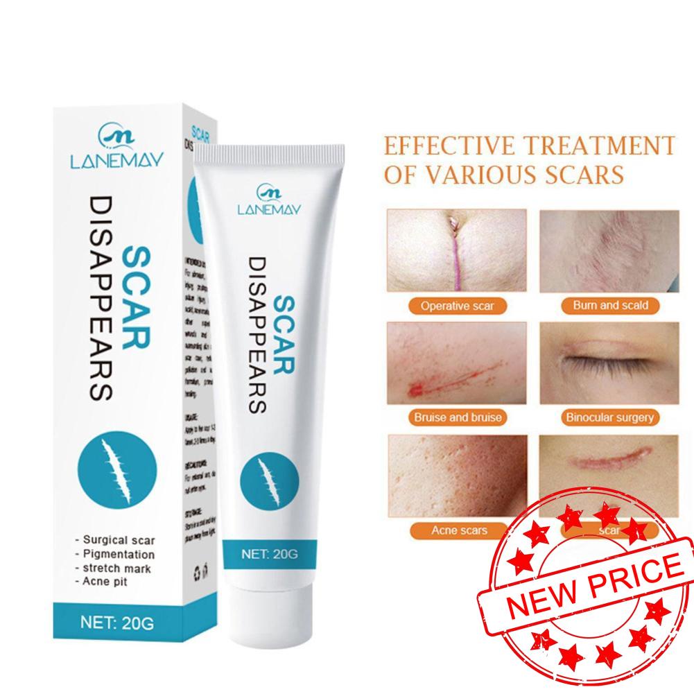 Scar Removal Cream Gel Repair Ointment Pock Mark Burn Scar Treatment