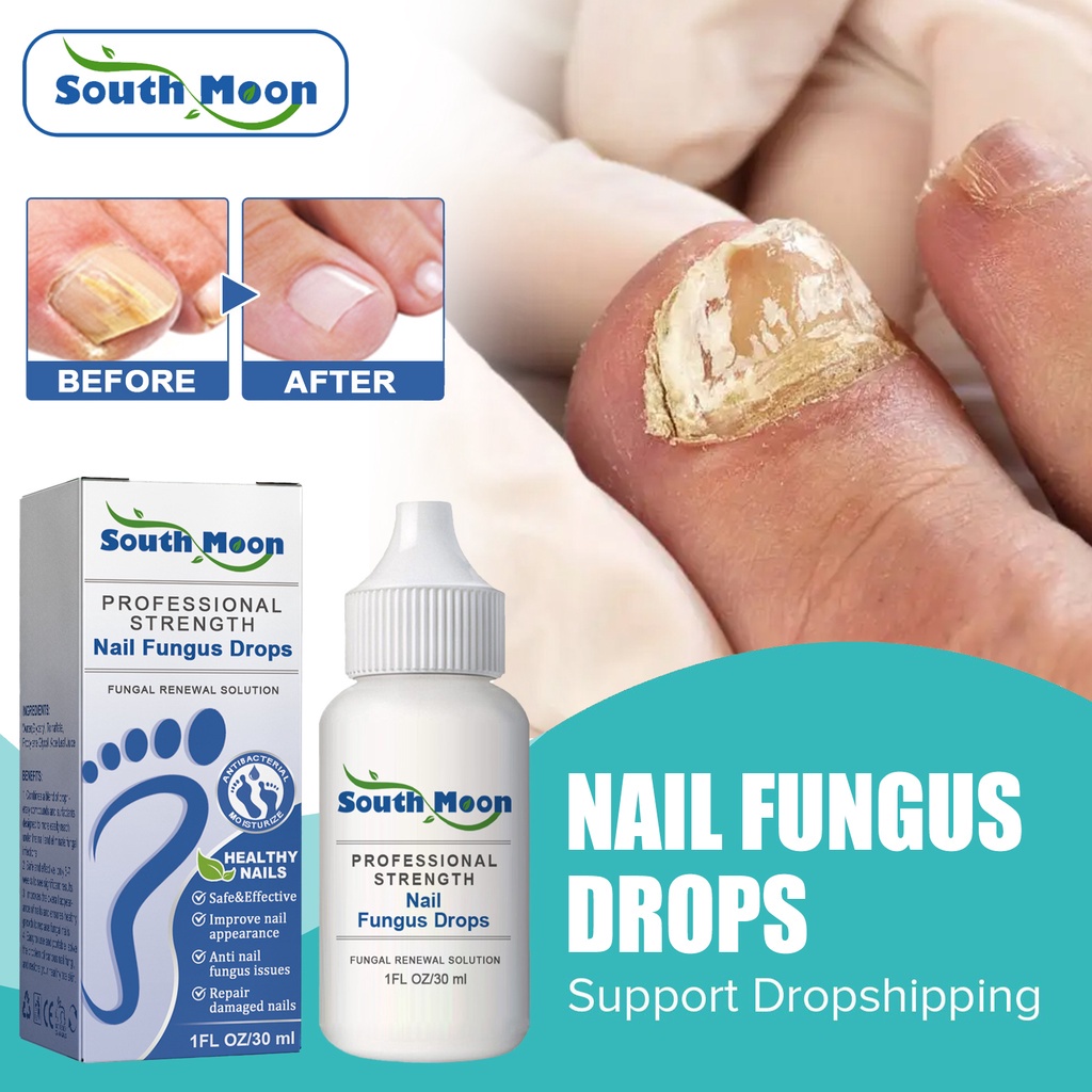 Anti Fungal Drops Anti Infection Paronychia Onychomycosis Hand Foot
