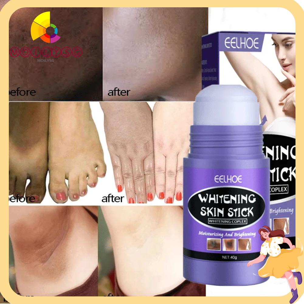 MOILYSG Whitening Cream, Lighten Melanin Moisturizing Hydration