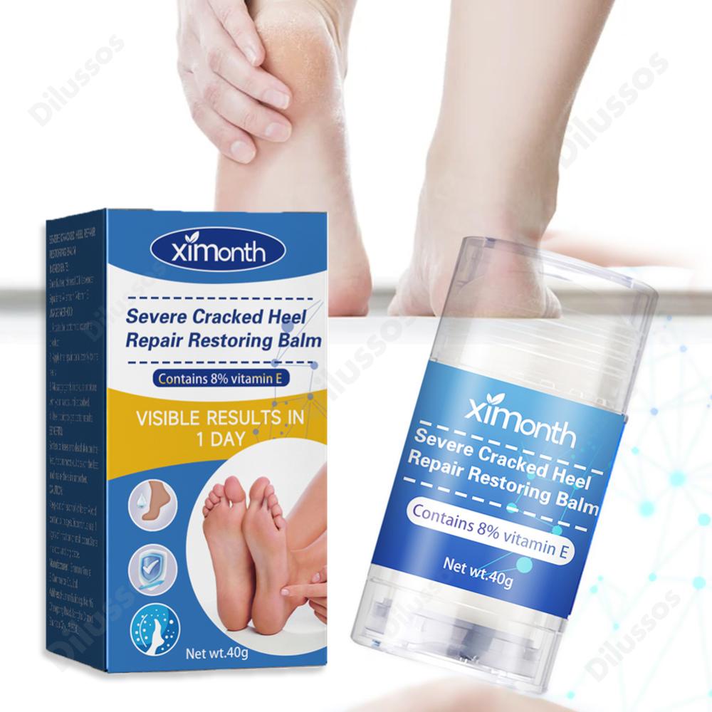 Urea Cream 42 with 2 Salicylic Acid Callus and Dead Skin Remover for Feet  Deeply Moisturizes Repairs Dry Cracked Rough Heels Elbow and Knee Effective  Urea Foot Cream with Foot File 3.5oz 3.5 oz