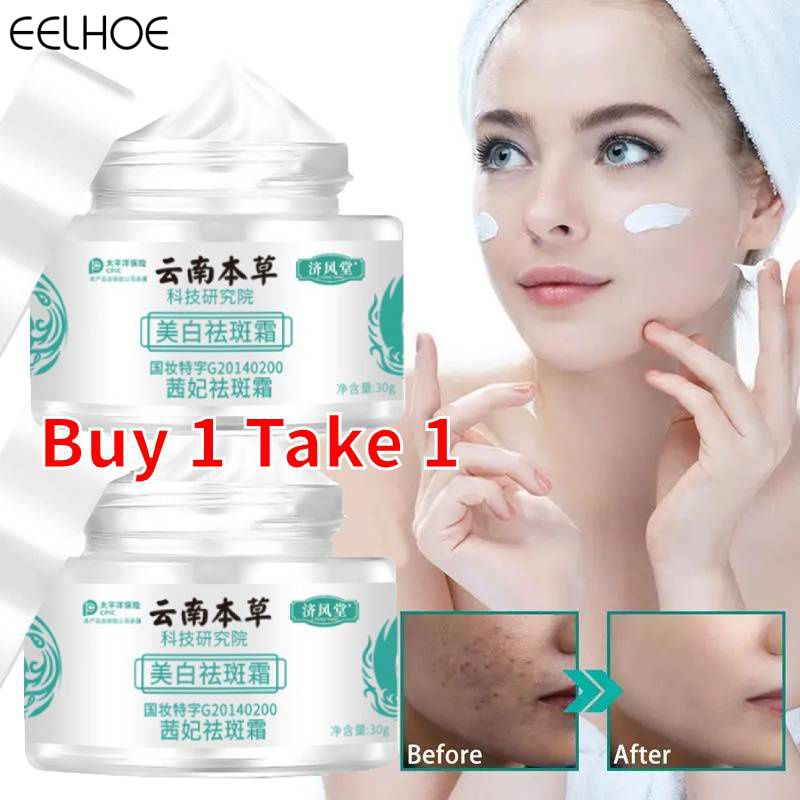 [buy 1 Take 1]japanese Melasma Cream White Spot Cream Skin Care Face ...