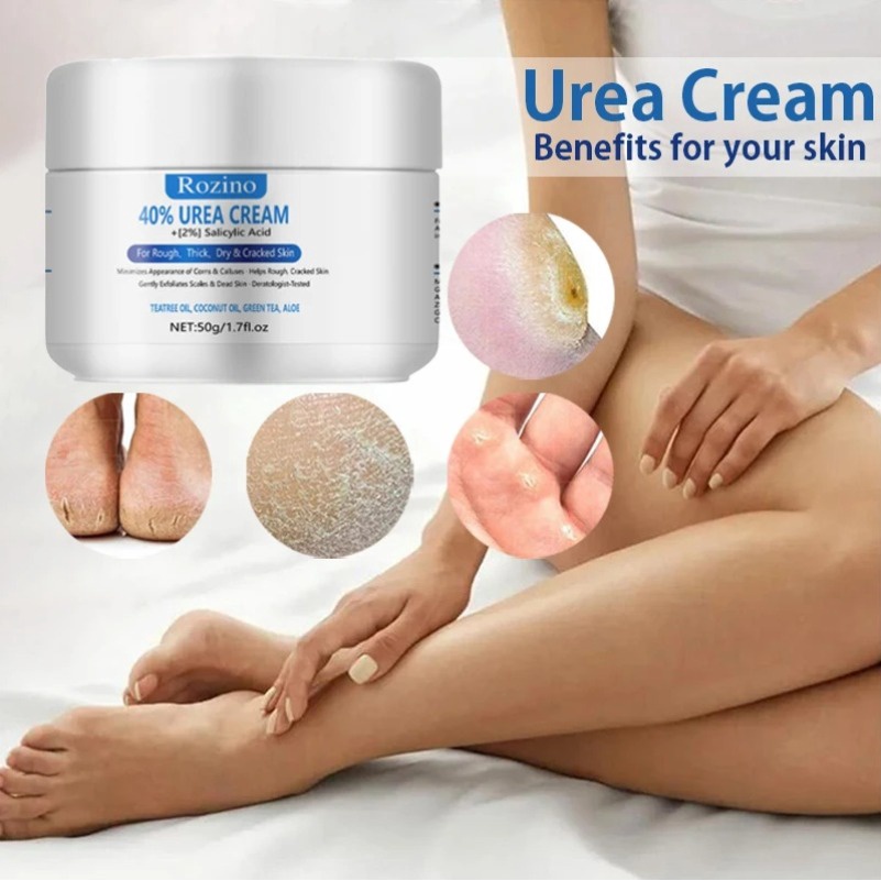 Urea Cream 42 with 2 Salicylic Acid Callus and Dead Skin Remover for Feet  Deeply Moisturizes Repairs Dry Cracked Rough Heels Elbow and Knee Effective  Urea Foot Cream with Foot File 3.5oz 3.5 oz