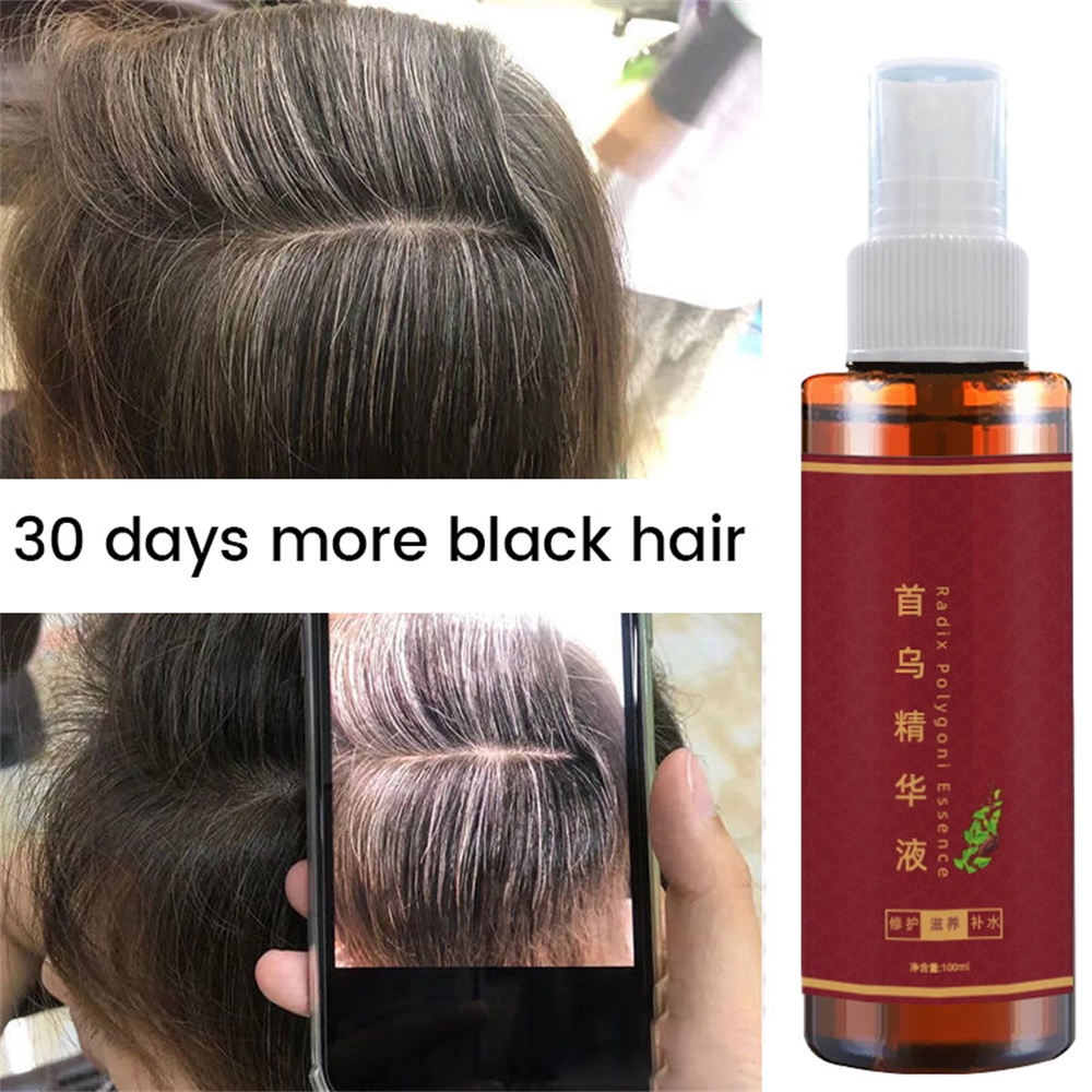 Herbal Gray Hair Spray Polygonum Multiflorum Herbal Extract Hair Treatment 3 Days Black Hair