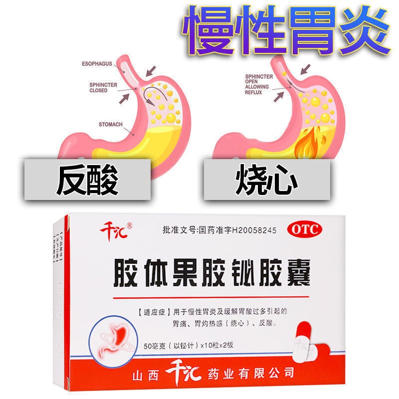 Chronic gastritis, acid reflux, heartburn, Helicobacter pylori, gastric