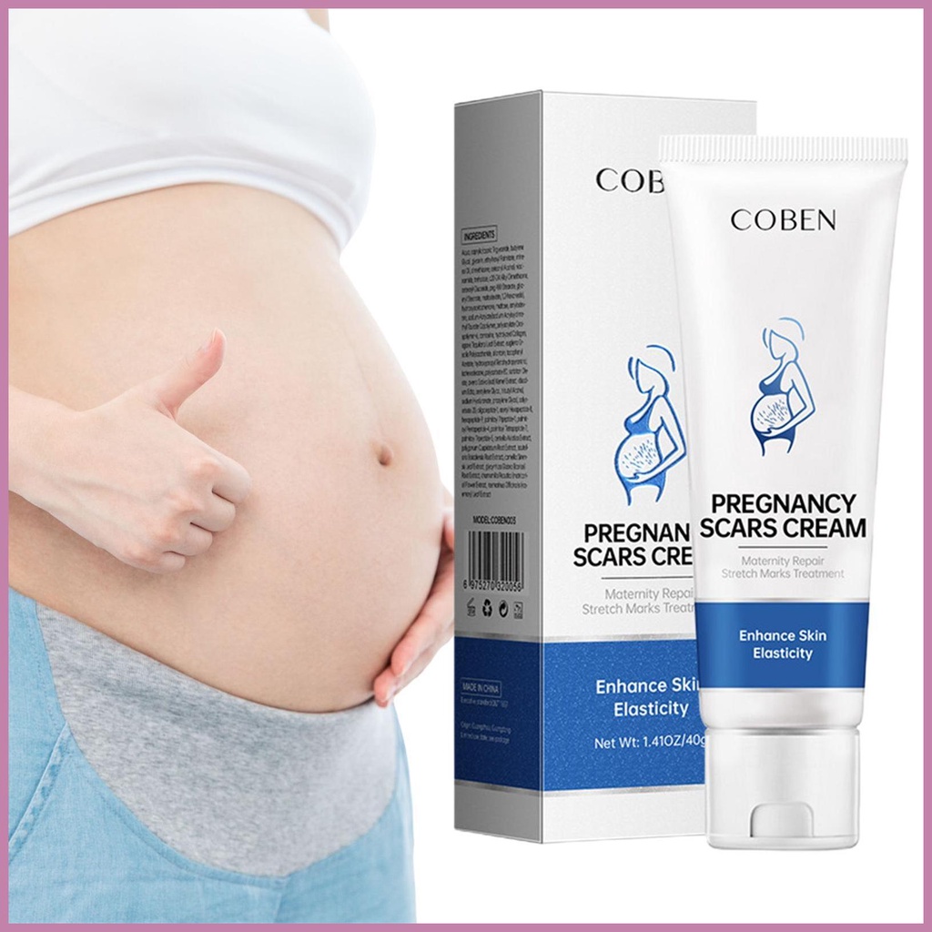 Stretch mark repair cream to lighten obesity marks, pregnancy mark