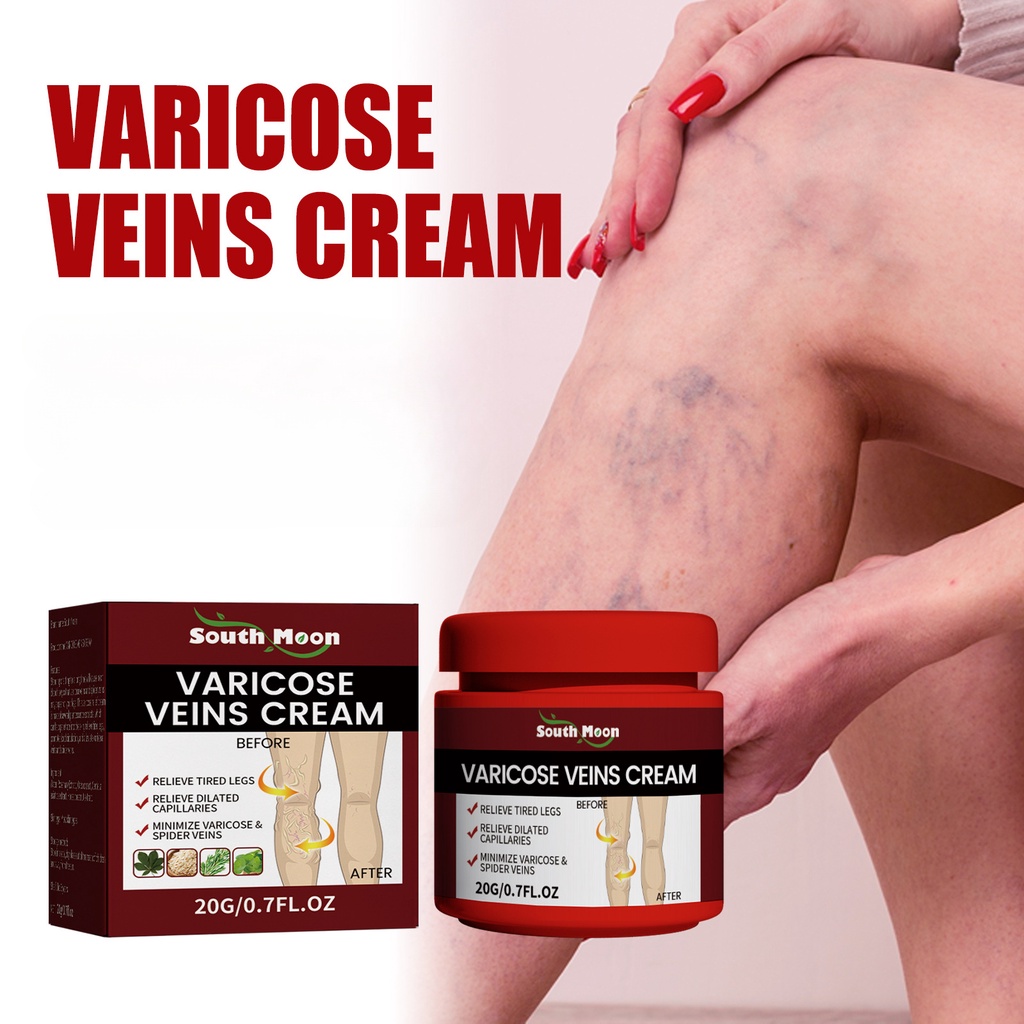 HEALTHTIME 20g Varicose Veins Cream, Varicose Veins Relief Cream ...