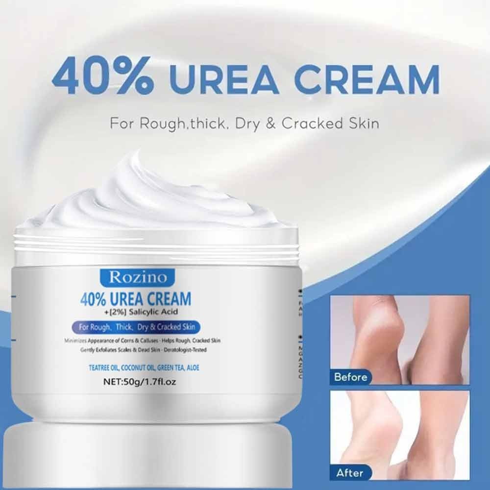 Coconut oil 40% urea hand and foot cream 50g hard dry skin crack heel ...