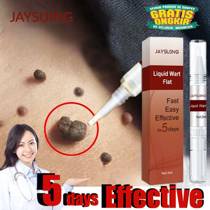 Jaysuing Mole Wart Remover Ointment Wart Remover Face Cleanser Liquid