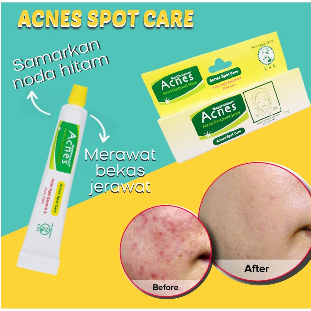 Acnes Spot Care 12gr / Merah Jingga Official - Gambar 2