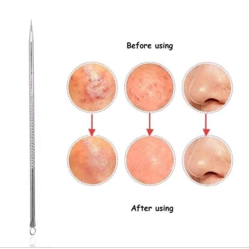 1PCS Alat Pencet Komedo Jerawat Perawatan Wajah Pencetan Jarum Pinset Stainless Kecil Facial Blackhead Removal A248 - Gambar 4