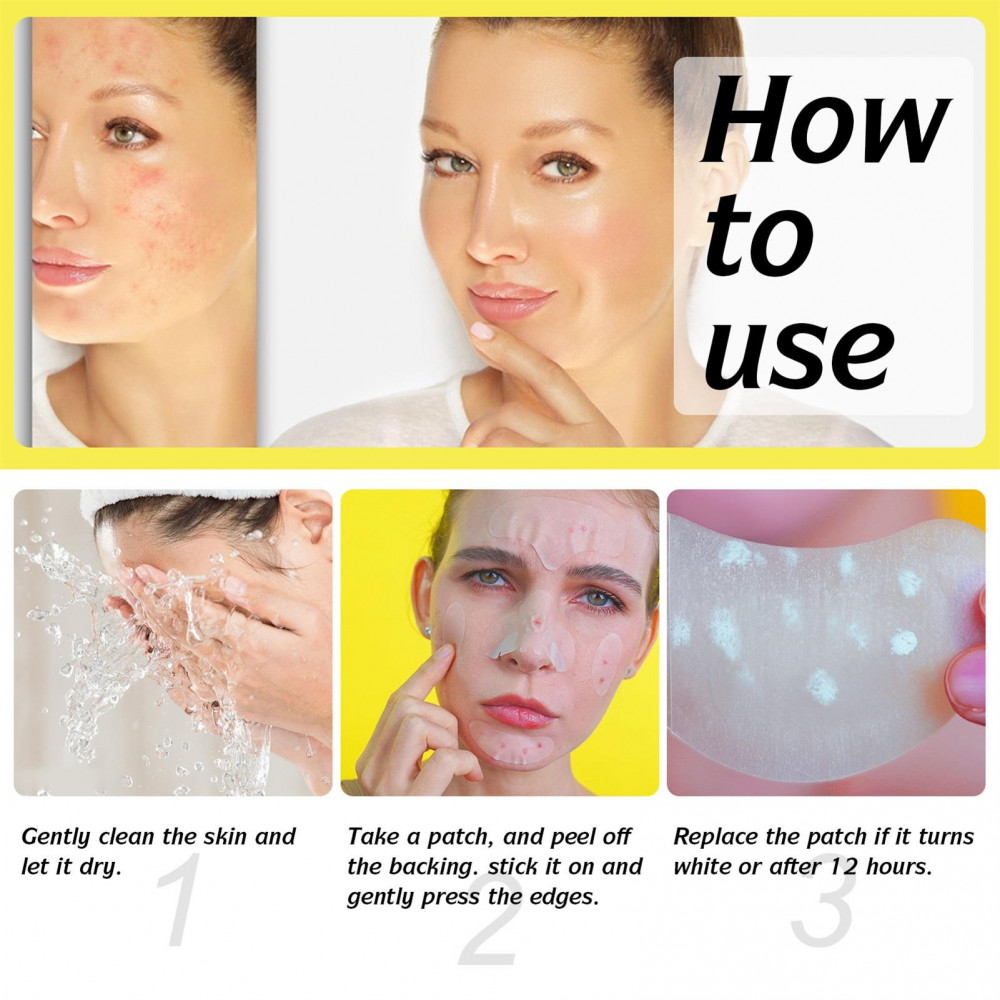 YL 5-in-1 Hydrocolloid Patches , Zit Stickers Pimple Patches ...