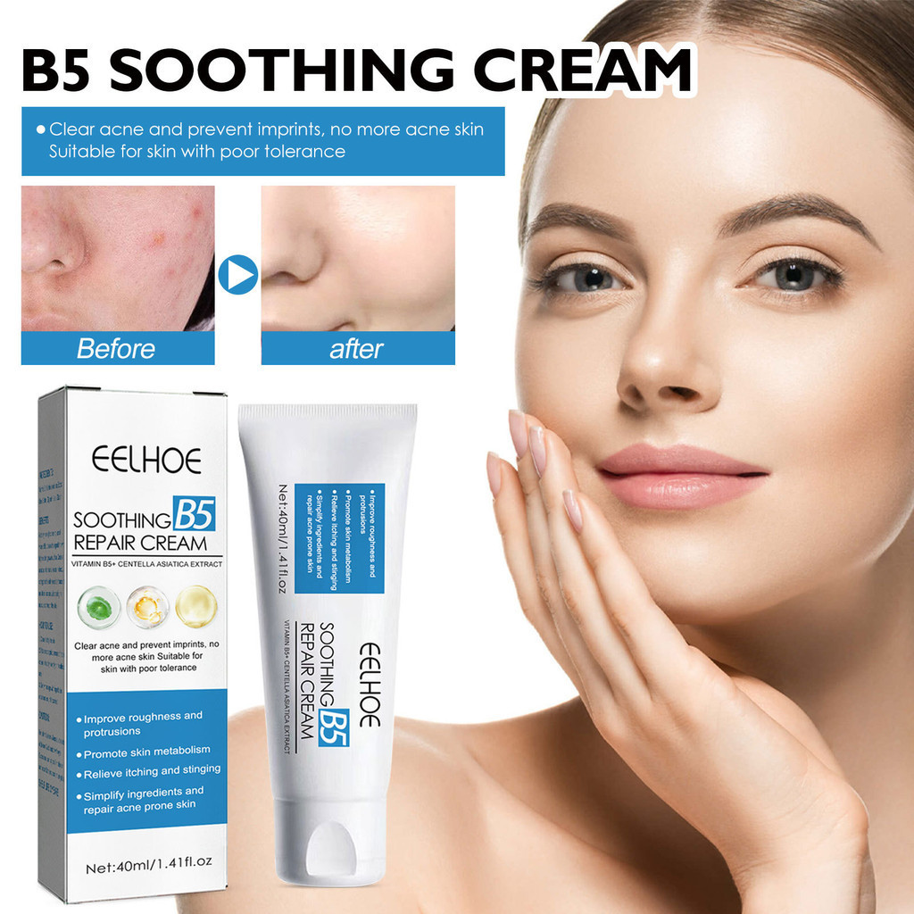 Acne Removal Cream Lighten Acne Marks Against Pimple Pore Refining Oil