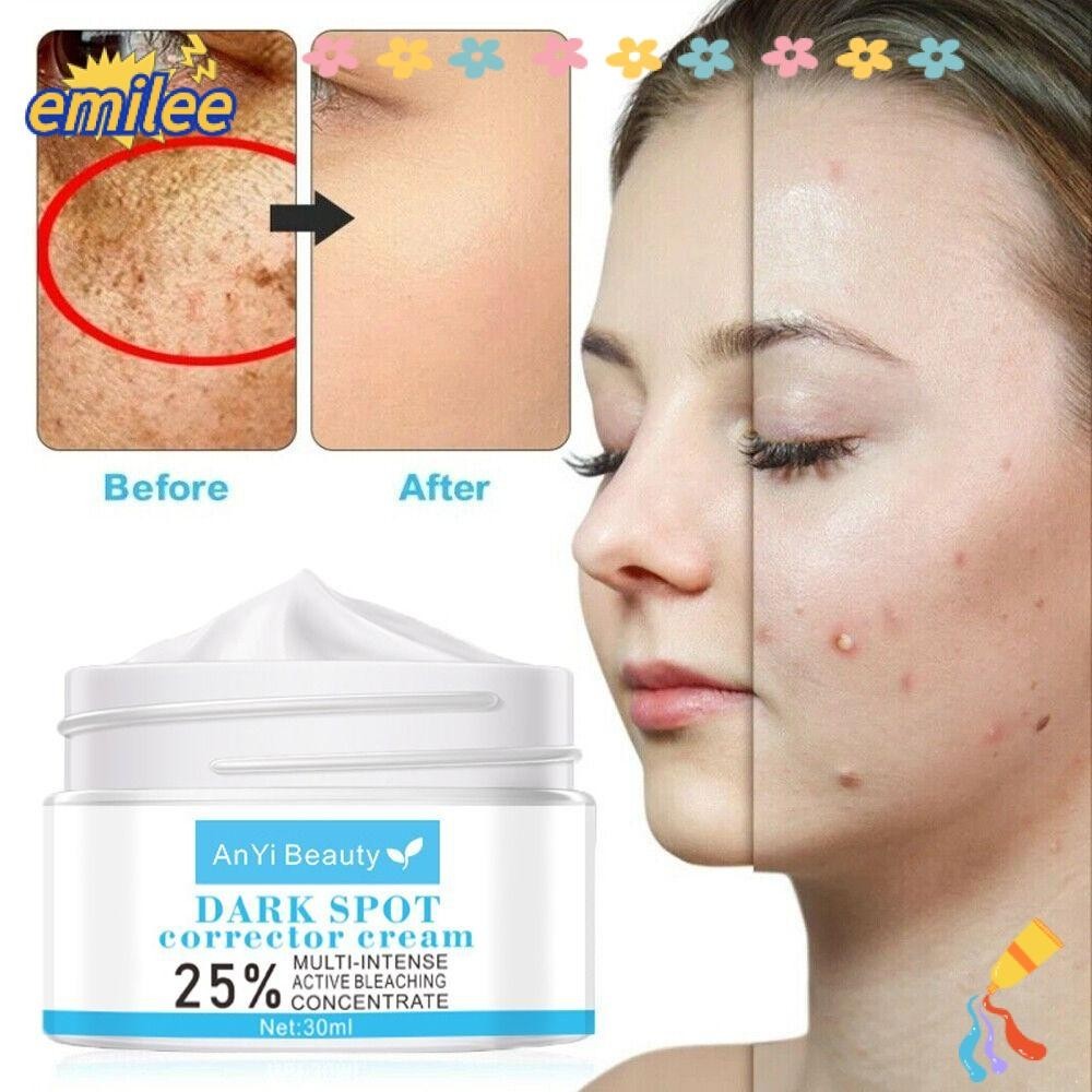 Emilee Dark Spot Corrector Cream Moisturizing Remove Speckle Removal Melasma Whitening Cream 6432