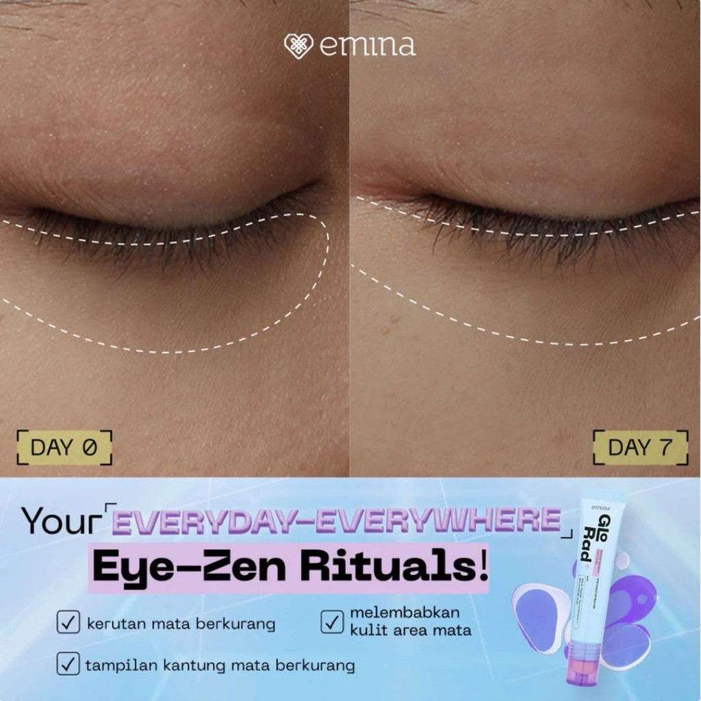 Emina [GLORAD+ Ultra HD Glow Series] - Glo Rad+ Instant Refresh Puffy Eye Wake Up Roller / MJO - Gambar 3