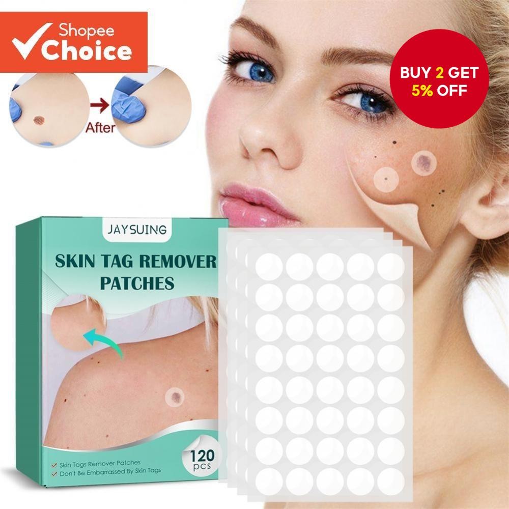 120pcs Wart Ta g Remover Patch Facial Acne Pimple Patches Skin Tag Mole ...