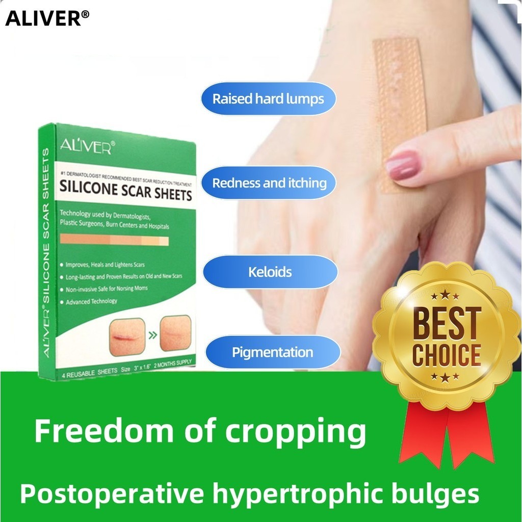 【Genuine】ALIVER Silicone Scar Sheets Self-Adhesive Caesarean Section ...