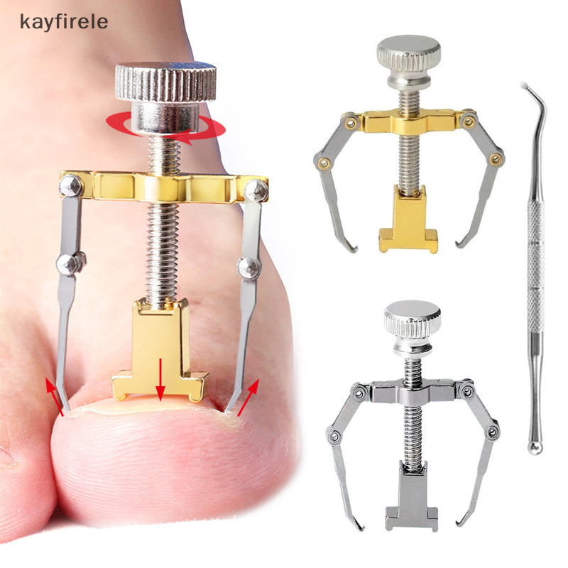 kayfirele Ingrown Toenail Correction Brace Kit Toe Nail Care Pedicure ...